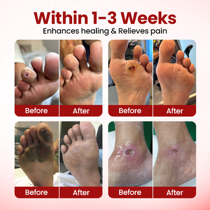 Cvreoz® DermaLuxe Diabetic Relief Cream