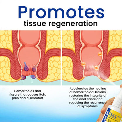 🔥 Official Store: INSTANT Pain Relief! 🌿Cvreoz® Botanical Hemorrhoids Intensive-Treatment Spray (Offer)