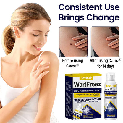 Cvreoz® WartFreez Cryo Wart Removal Spray