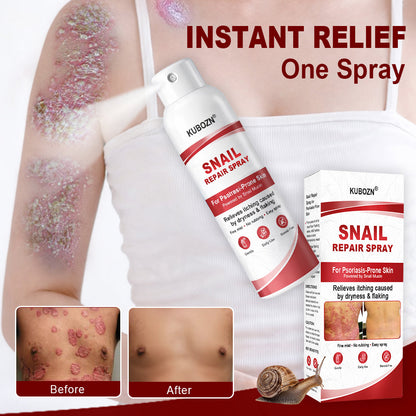 KUBOZN® Snail Repair Spray for Itchy, Flaky Psoriasis Skin 1