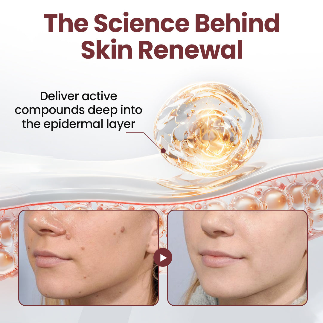 KUBOZN®KeraErase Dual-Action Renewal Cream (Offer)