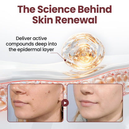 KUBOZN®KeraErase Dual-Action Renewal Cream (Offer)