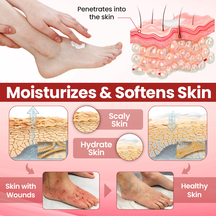 Cvreoz® DermaLuxe Diabetic Relief Cream