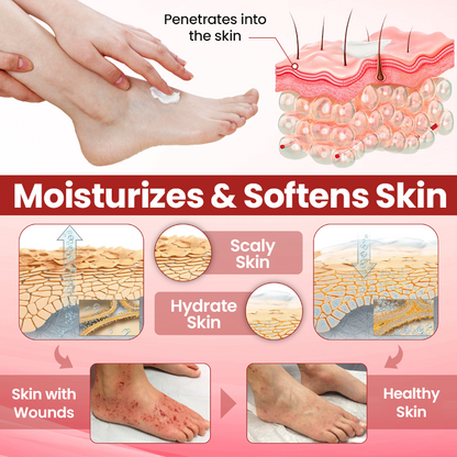 Cvreoz® DermaLuxe Diabetic Relief Cream