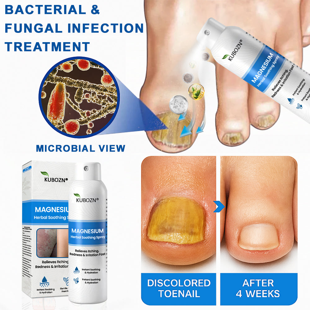 ✅  Official Store: KUBOZN® Magnesium Herbal Psoriasis Spray ⚕️ FDA Certified (Offer)