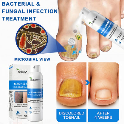 ✅  Official Store: KUBOZN® Magnesium Herbal Psoriasis Spray ⚕️ FDA Certified (Offer)