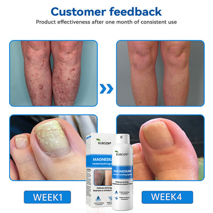 ✅  Official Store: KUBOZN® Magnesium Herbal Psoriasis Spray ⚕️ FDA Certified (Offer)