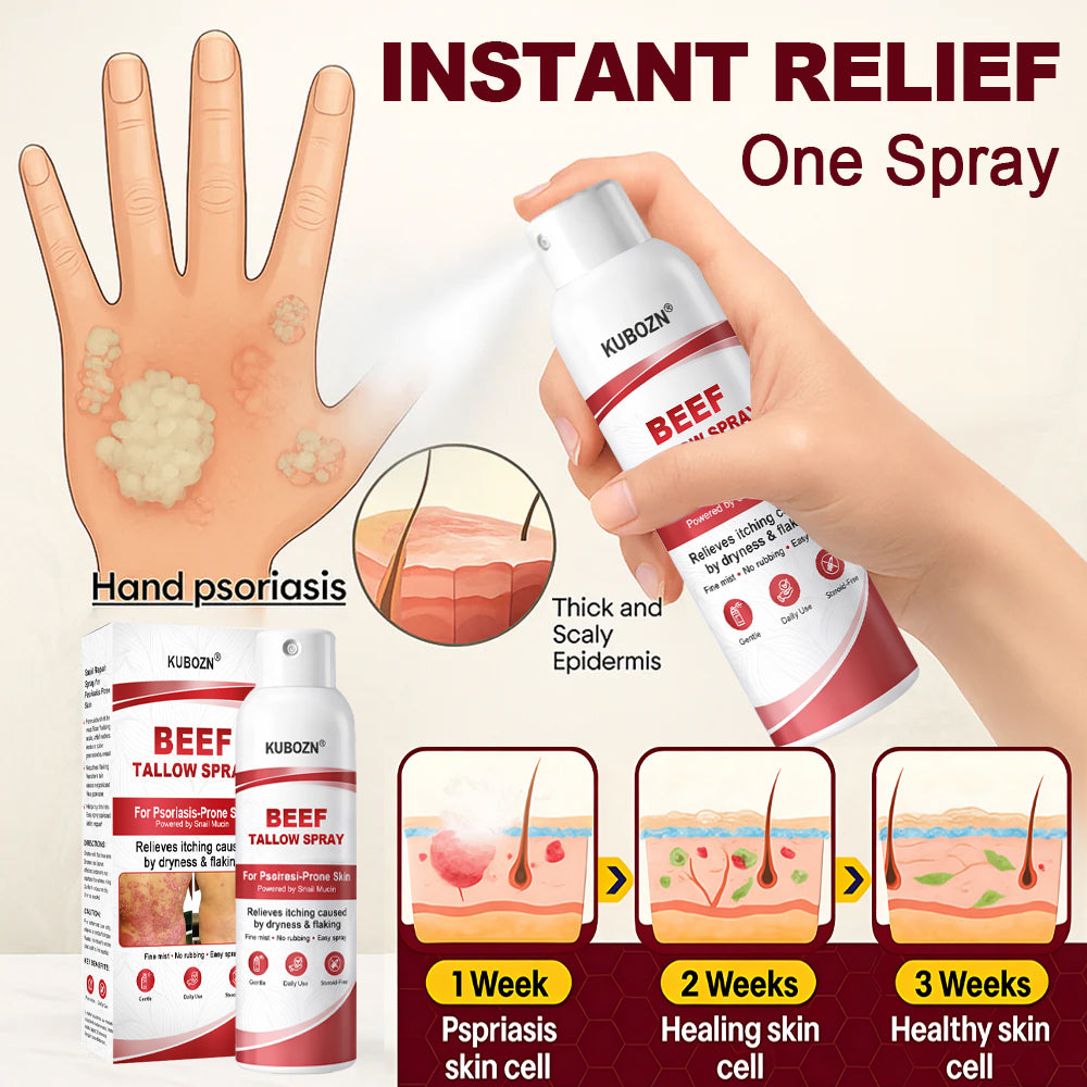KUBOZN® Beef Tallow Spray for Itchy, Flaky Psoriasis Skin (offer)
