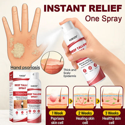 KUBOZN® Beef Tallow Spray for Itchy, Flaky Psoriasis Skin