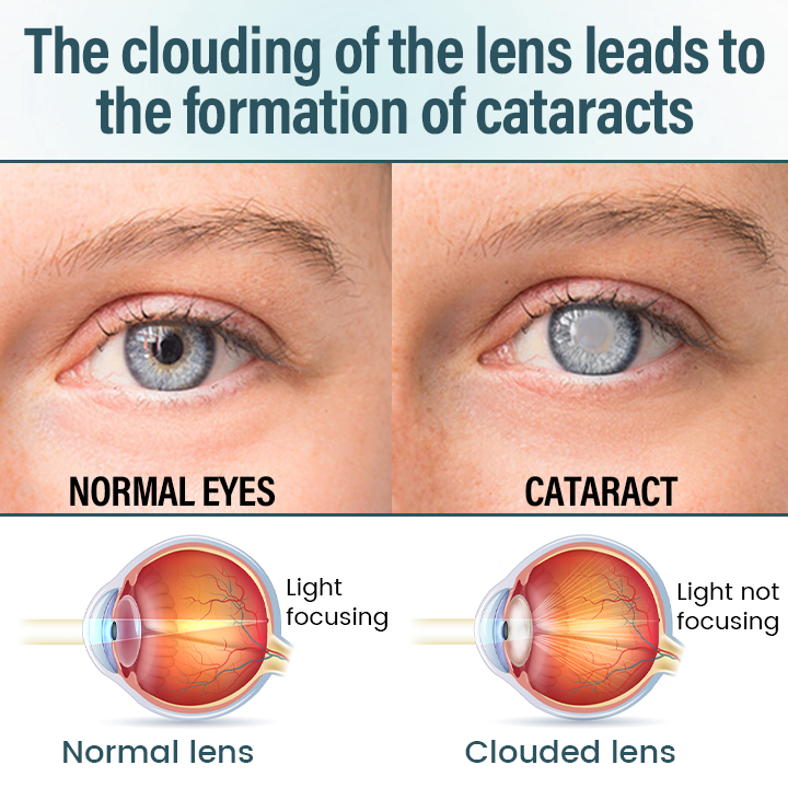 Cvreoz® Clarivis Nano Eye Care Serum