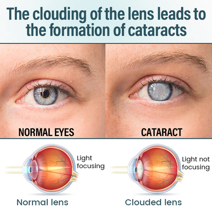 Cvreoz® Clarivis Nano Eye Care Serum