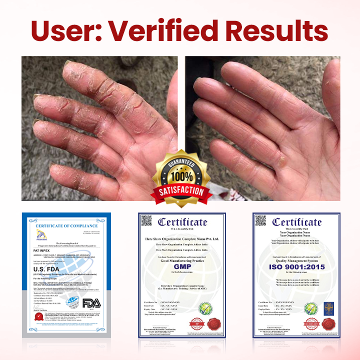 Cvreoz® DermaLuxe Diabetic Relief Cream