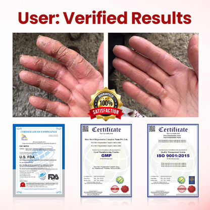 Cvreoz® DermaLuxe Diabetic Relief Cream