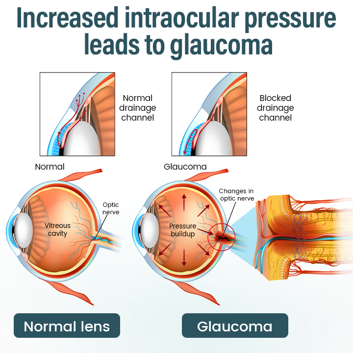 Cvreoz® Clarivis Nano Eye Care Serum