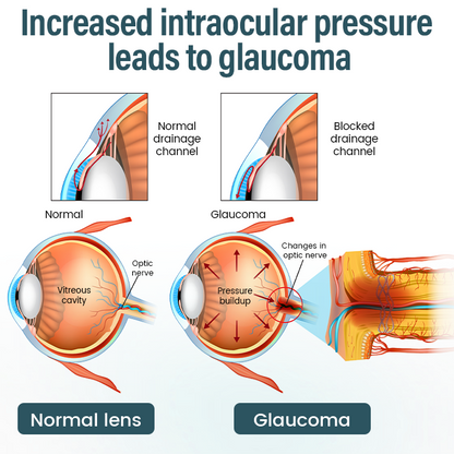 Cvreoz® Clarivis Nano Eye Care Serum