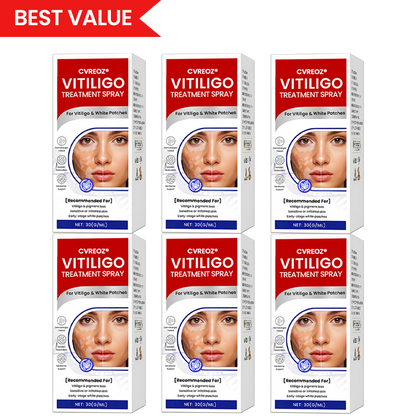 Cvreoz® Vitiligo Treatment Spray — Visible Results in Weeks, 100% Natural & Steroid-Free (Offer)