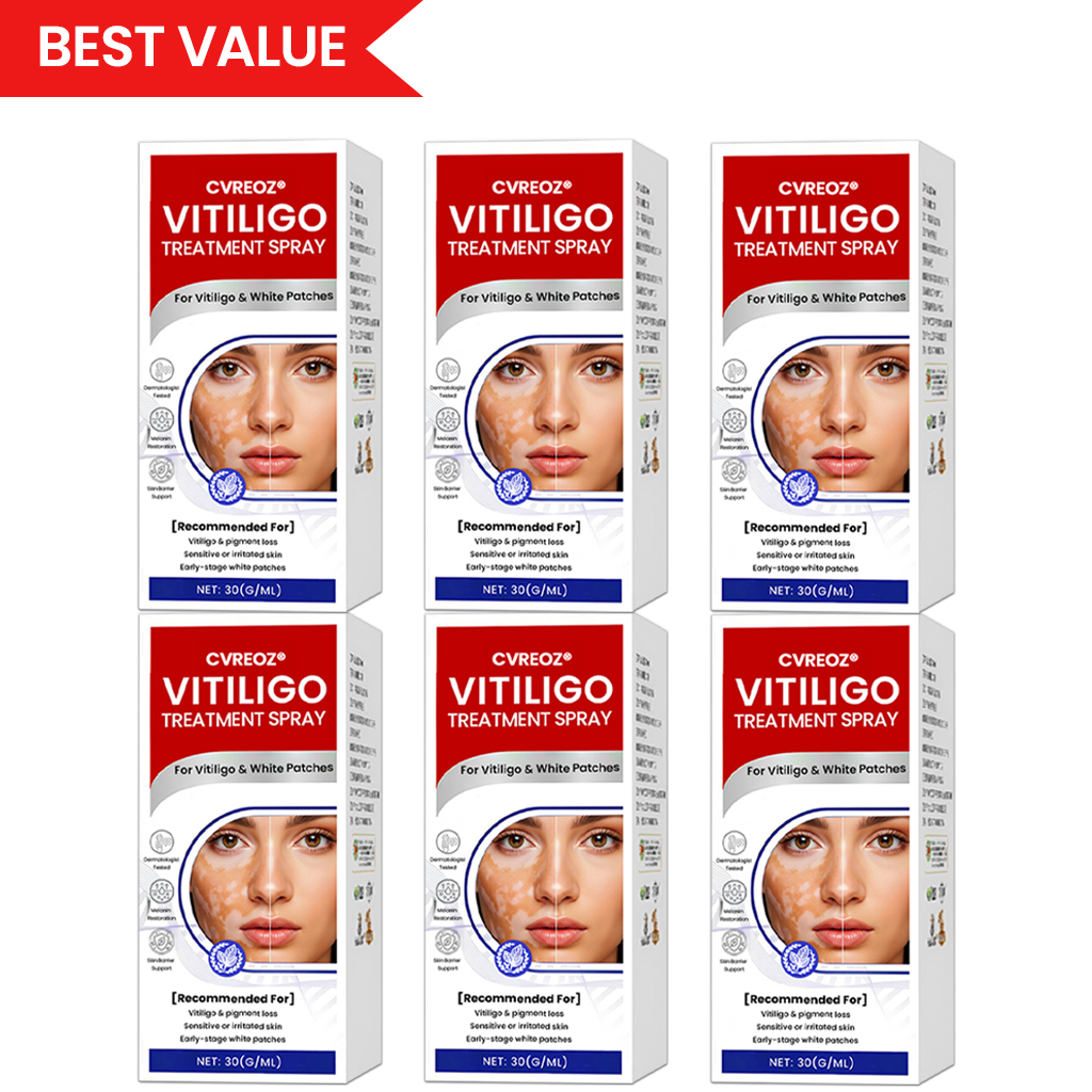 Cvreoz® Vitiligo Treatment Spray — Visible Results in Weeks, 100% Natural & Steroid-Free