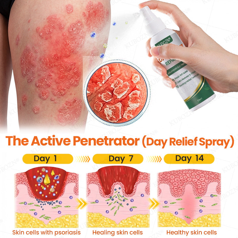 KUBOZN® Psoriasis Day & Night Repair System - 100% Steroid-Free Relief Duo for Plaques, Scaling & Itch (offer)