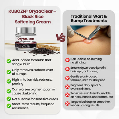 KUBOZN®KeraErase Dual-Action Renewal Cream (Offer)