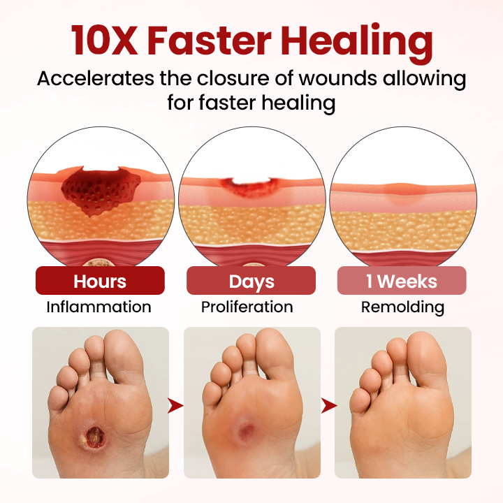 Cvreoz® DermaLuxe Diabetic Relief Cream