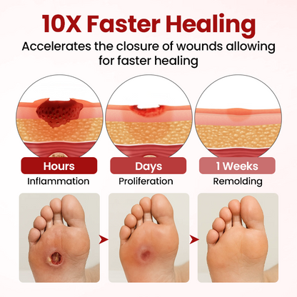 Cvreoz® DermaLuxe Diabetic Relief Cream