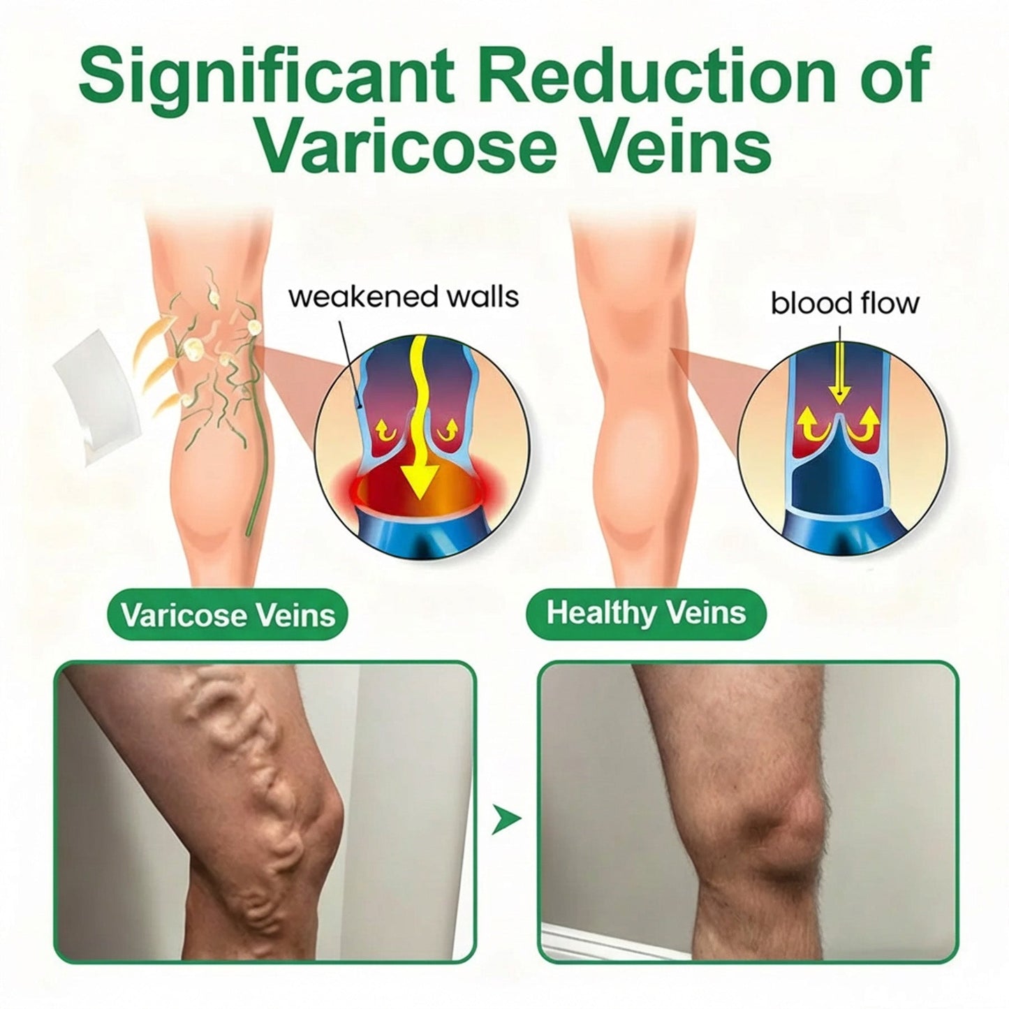 👨‍⚕️🔥Healrize® VeinEase Microneedle Care Patch⚡Instant Relief, Long-Term Results (Offer)