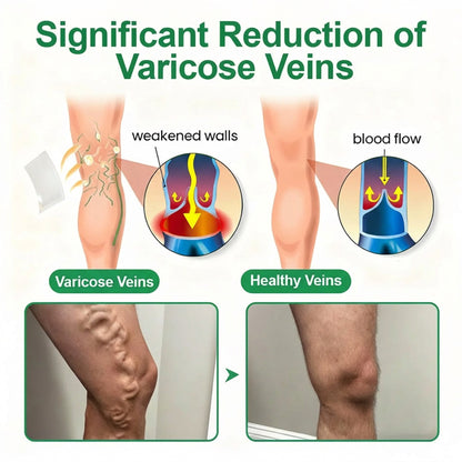 👨‍⚕️🔥Healrize® VeinEase Microneedle Care Patch⚡Instant Relief, Long-Term Results (Offer)