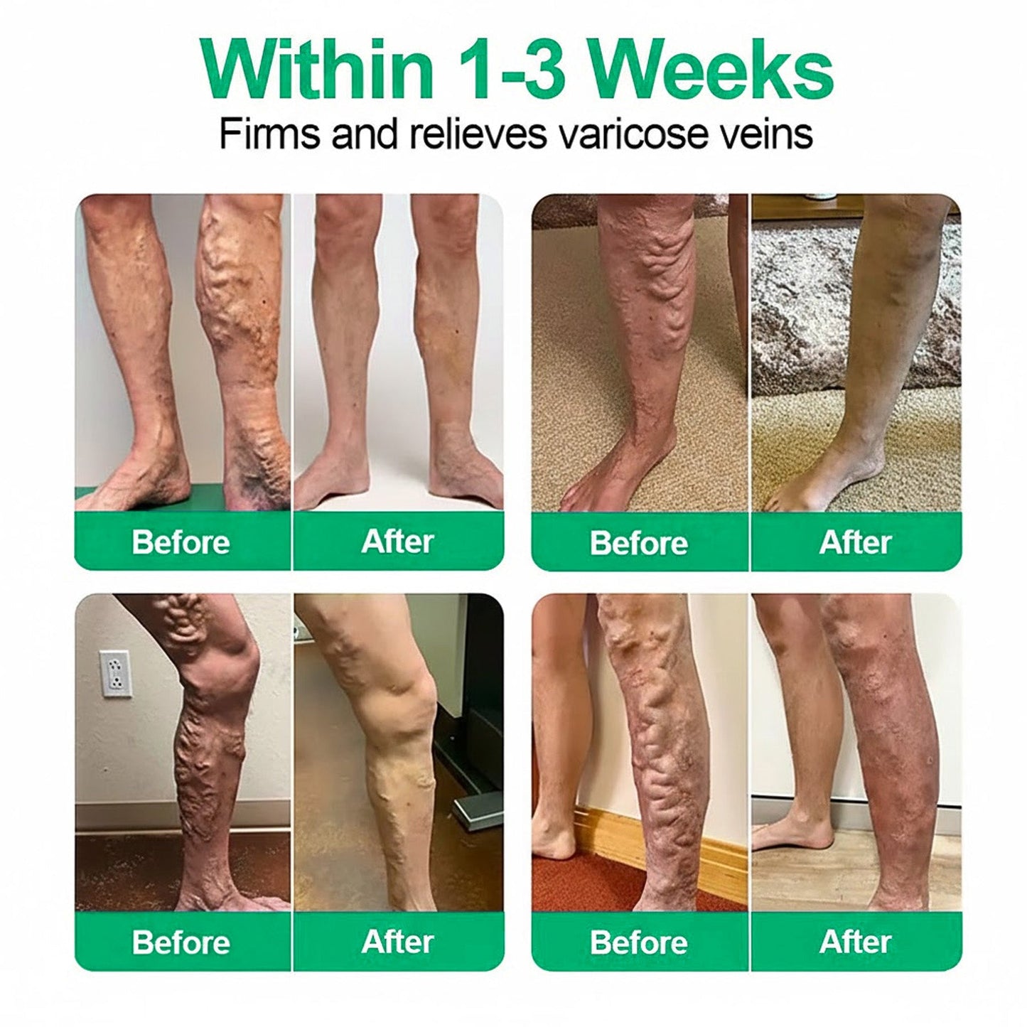 👨‍⚕️🔥Healrize® VeinEase Microneedle Care Patch⚡Instant Relief, Long-Term Results (Offer)