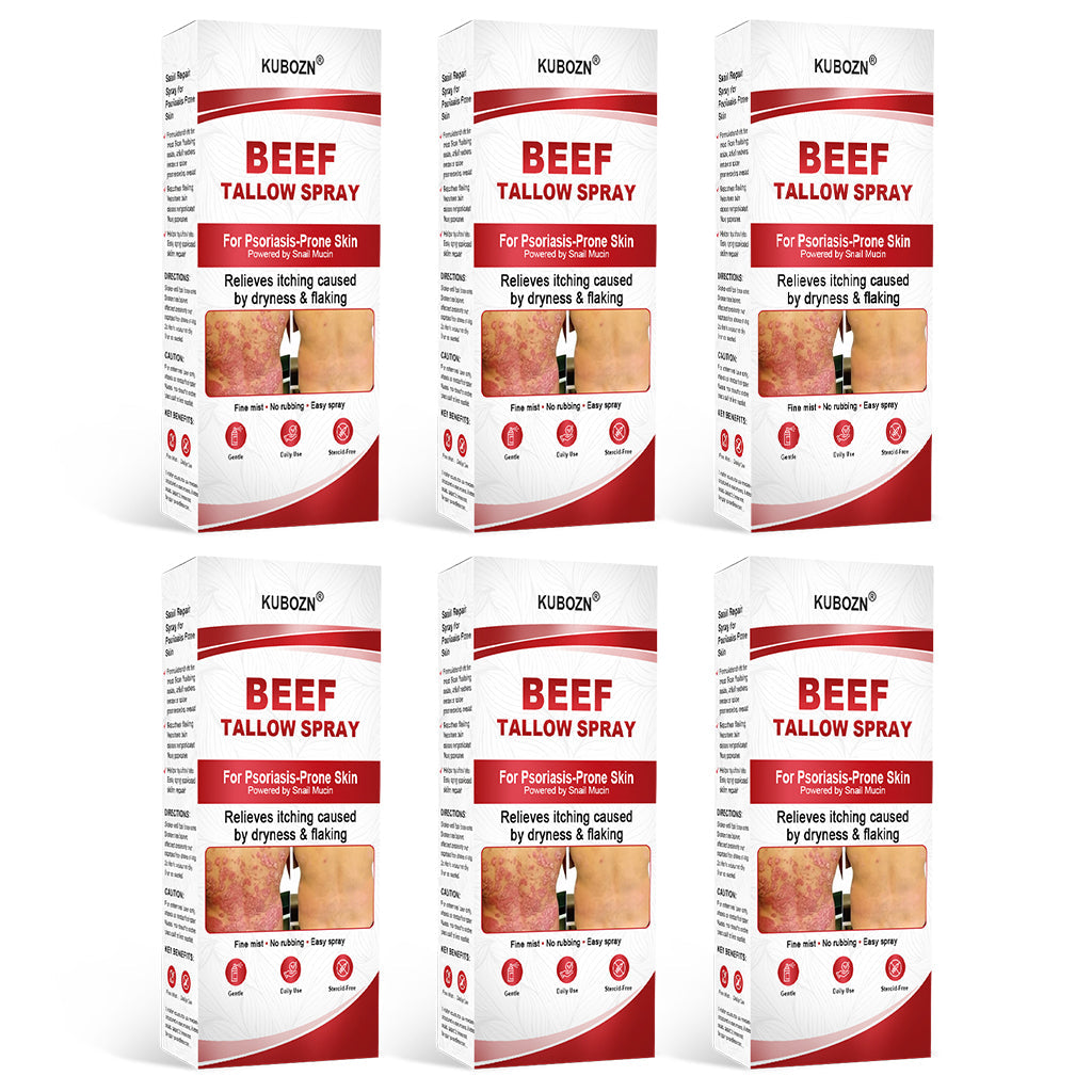 KUBOZN® Beef Tallow Spray for Itchy, Flaky Psoriasis Skin (offer)