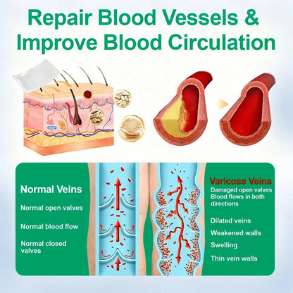 👨‍⚕️🔥Healrize® VeinEase Microneedle Care Patch⚡Instant Relief, Long-Term Results (Offer)